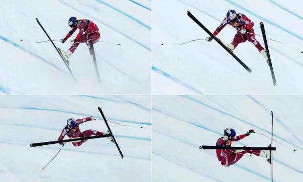 After just one World Cup win, Marc Girardelli suffered the worst knee injury Dr. Richard Steadman said he had ever seen. After Steadman surgery, Girardelli was racing the next season and went on to win five Overall World Cup titles.