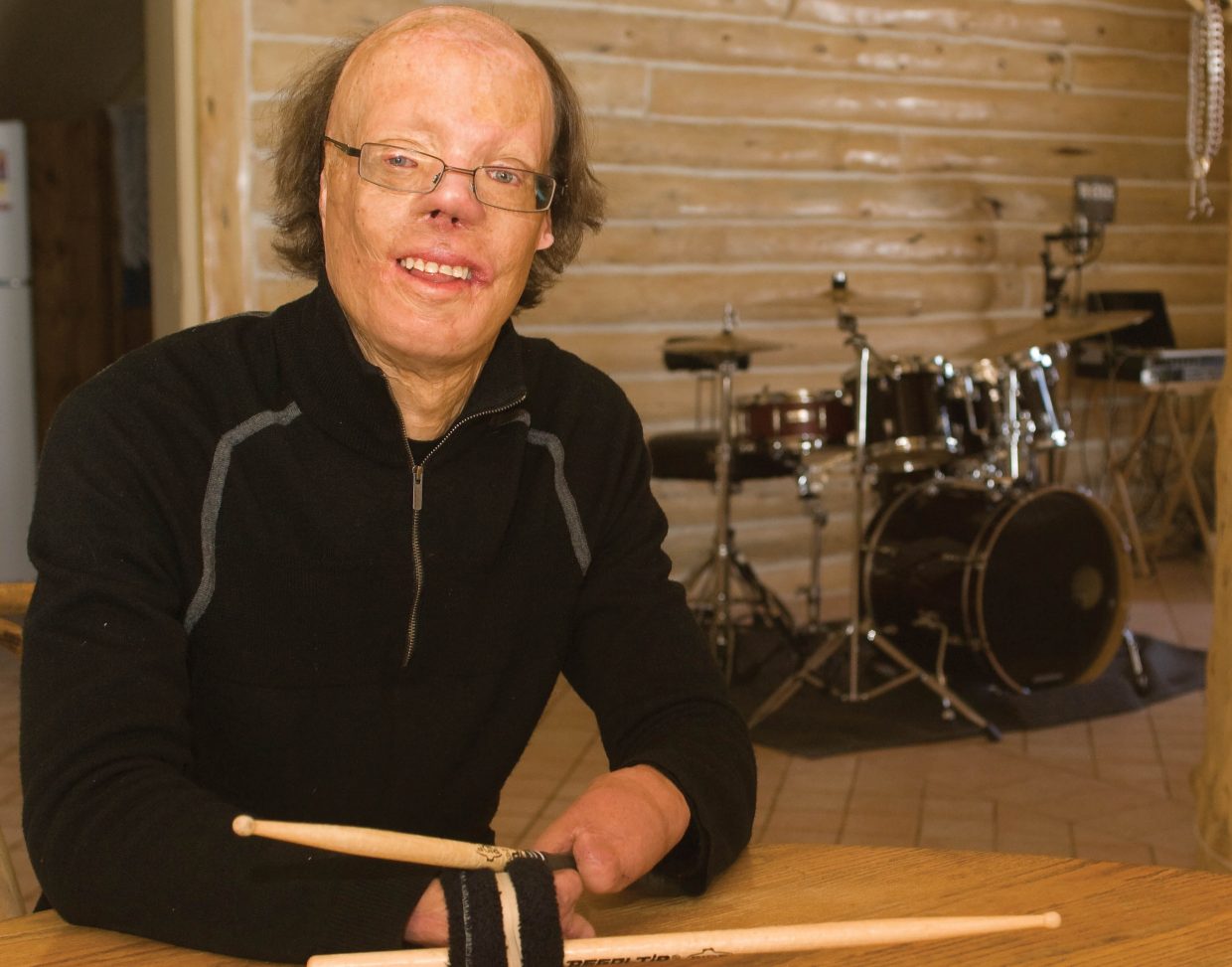 New Orleans drummer, burn survivor Caro is all in | SteamboatToday.com